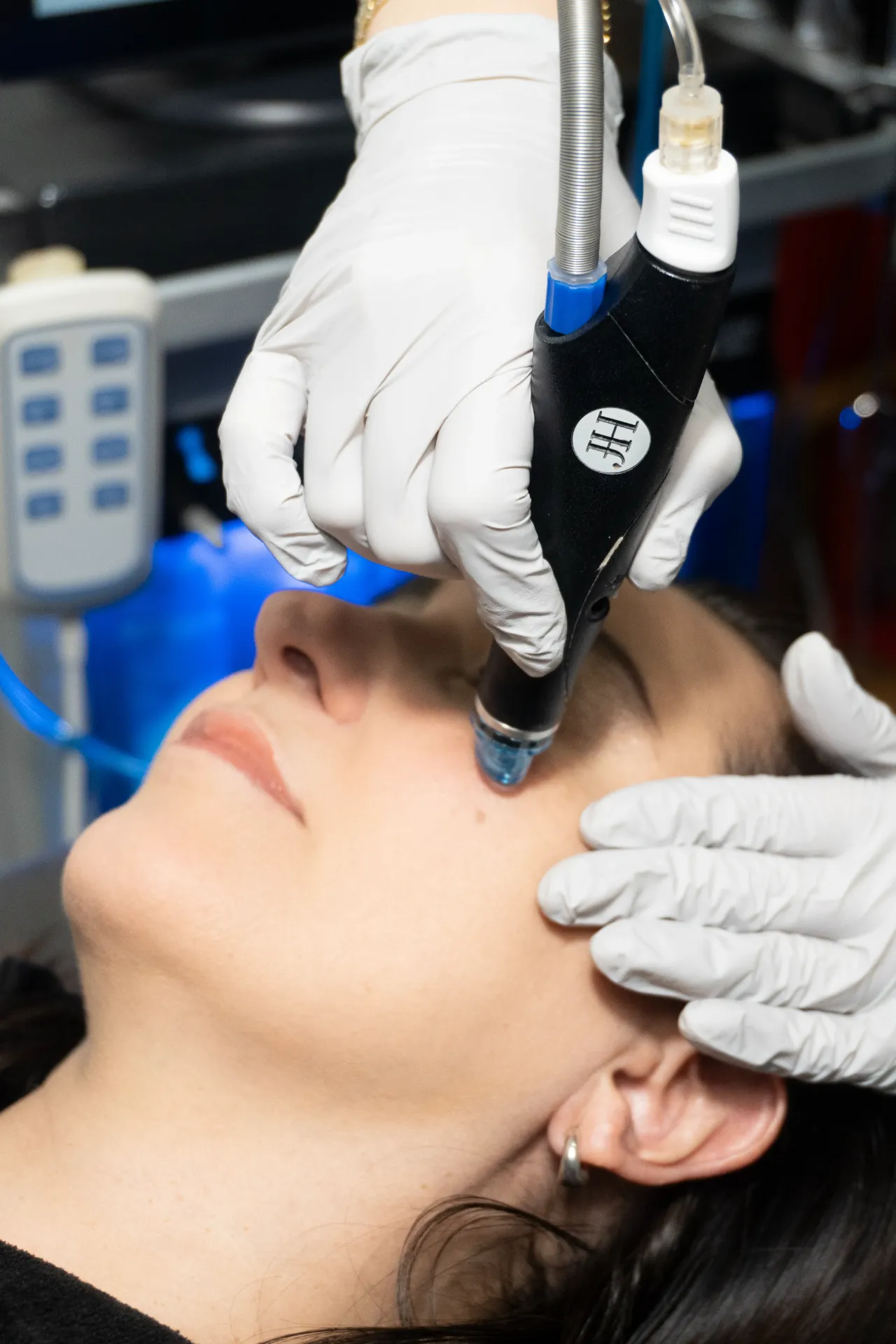 Hydrafacial