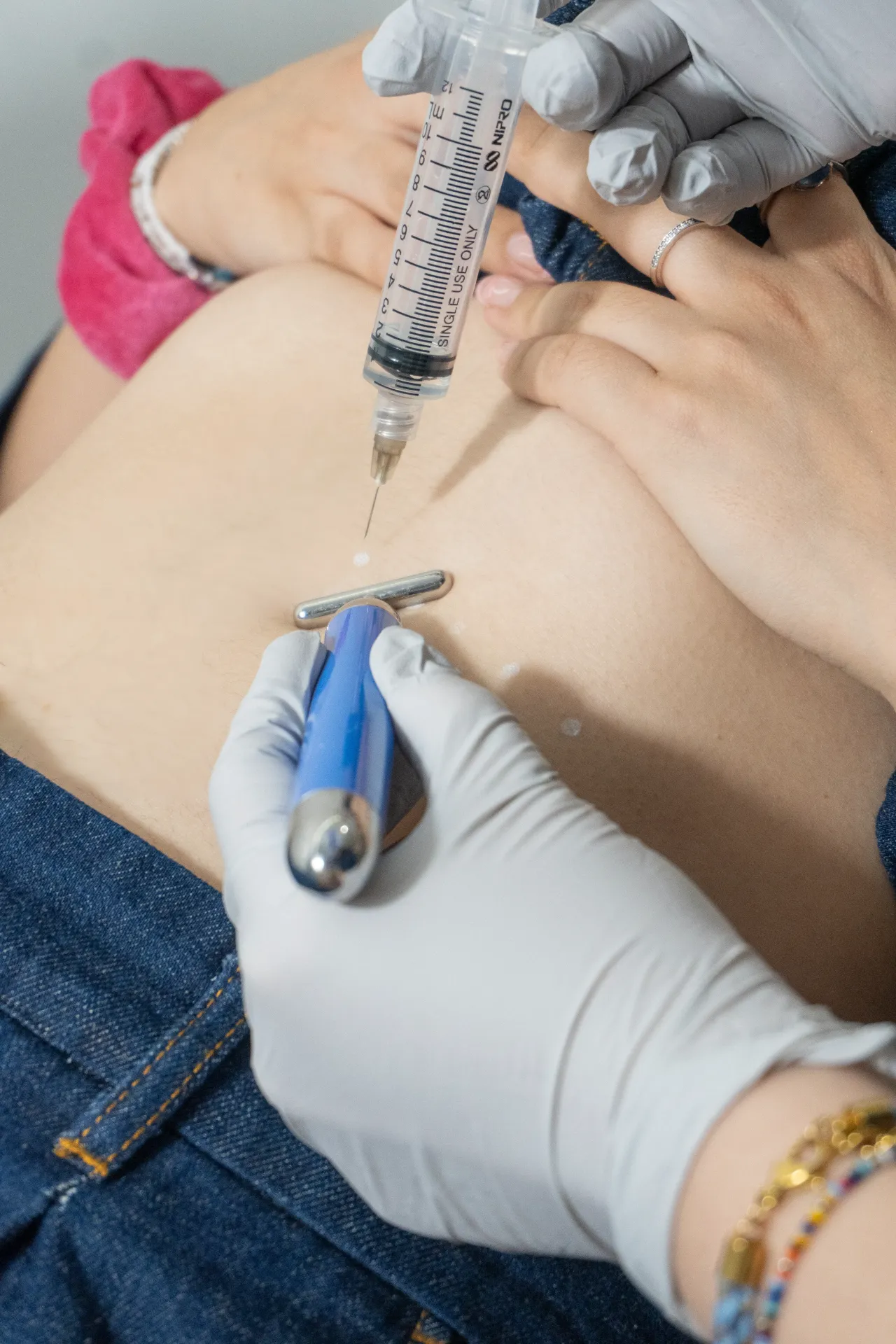 Body Mesotherapy