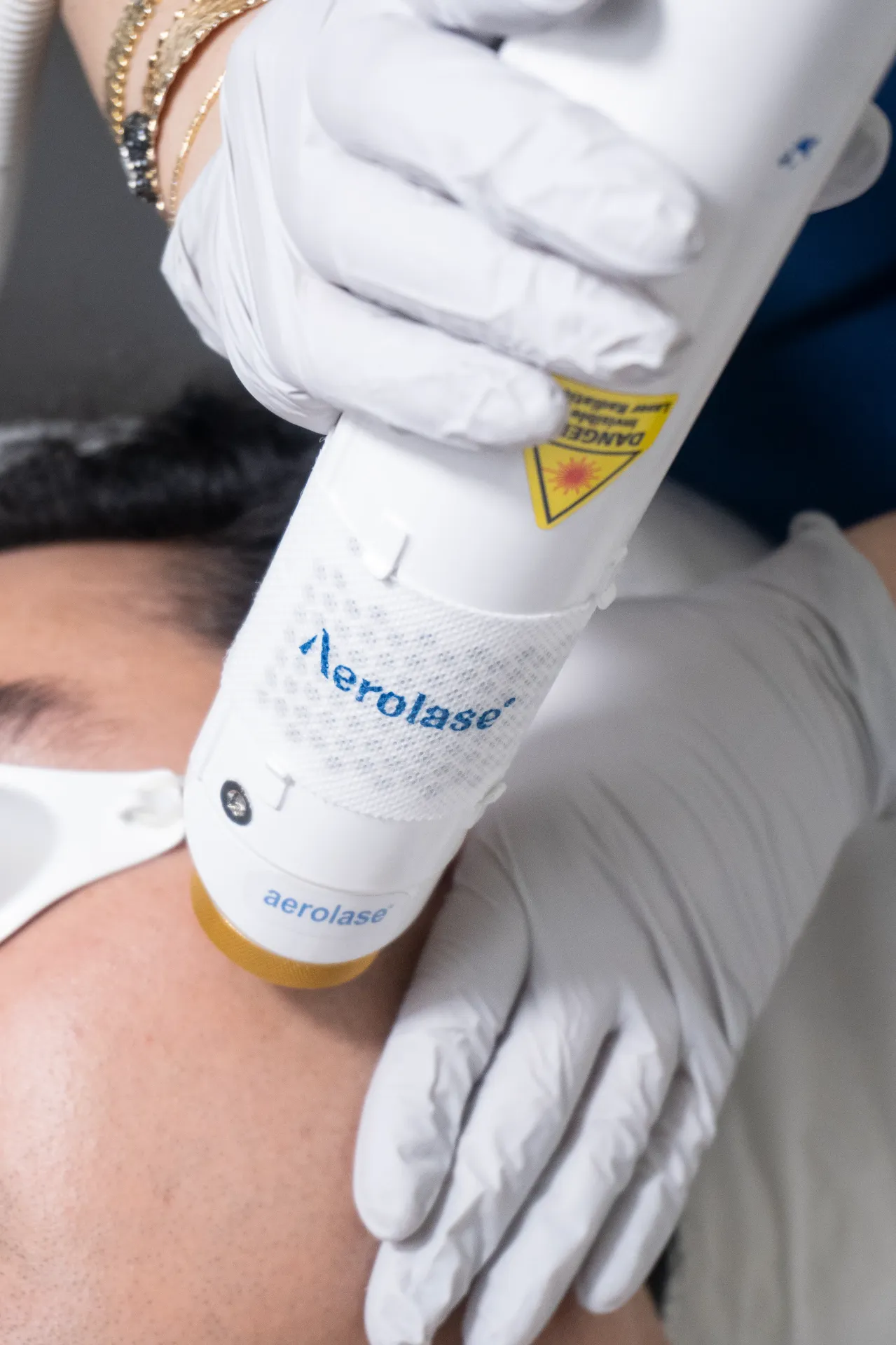 Aerolase